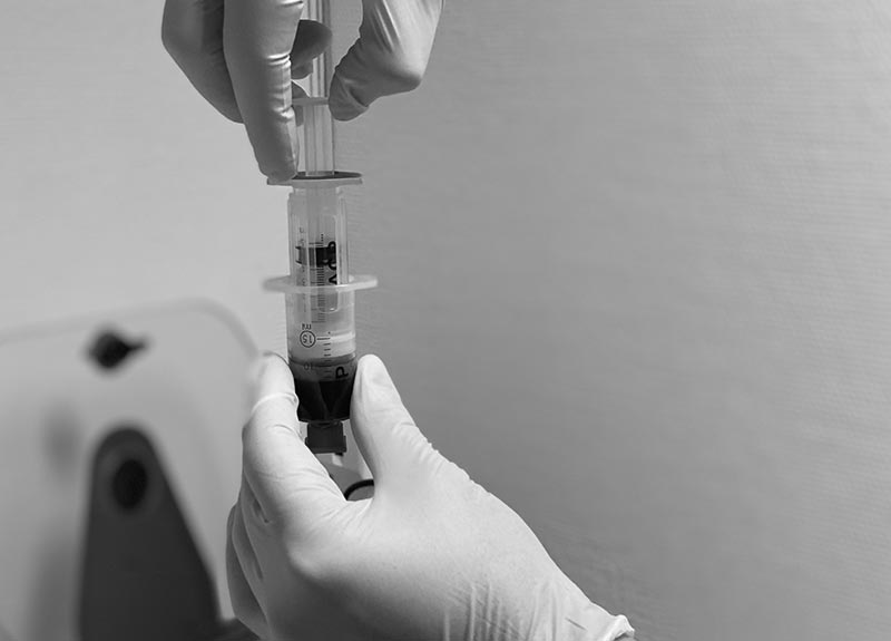 sproyte-fra-prp-platerikt-plasma-behandling-strommen mor som ammer